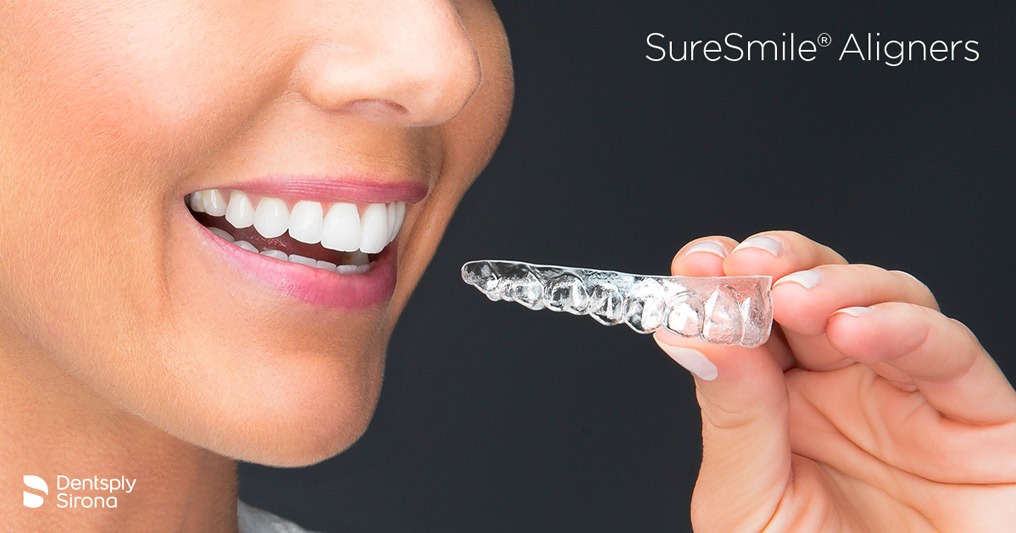 Clear aligners (SureSmile)